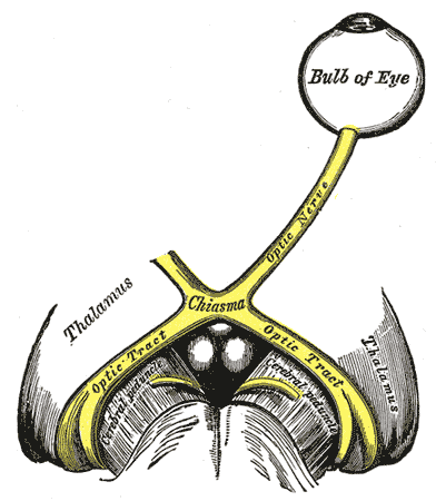 Left optic nerve2